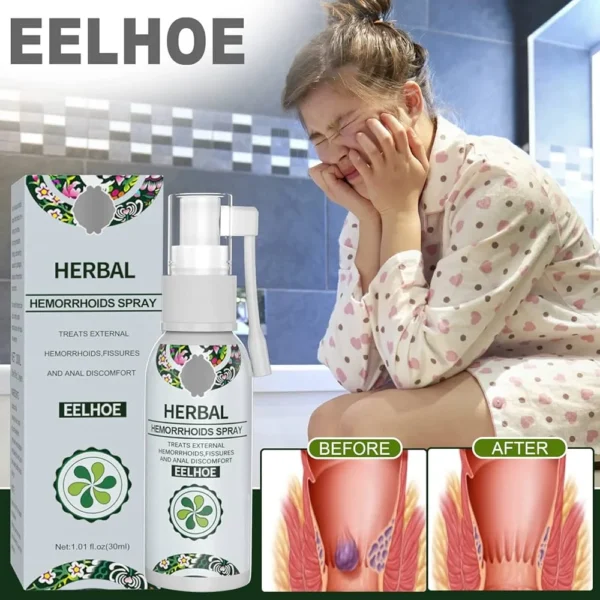 30ml Hemorrhoid Treatment Spray Natural